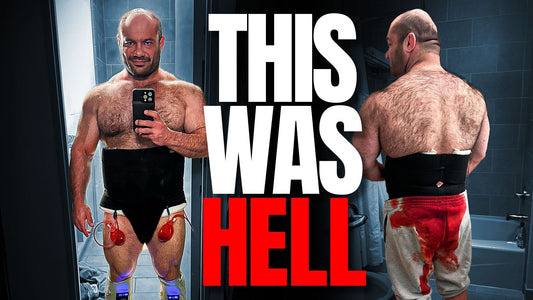 Dr. Mike's Brutal Physique-Altering Surgery Experience (Graphic Medical Content)